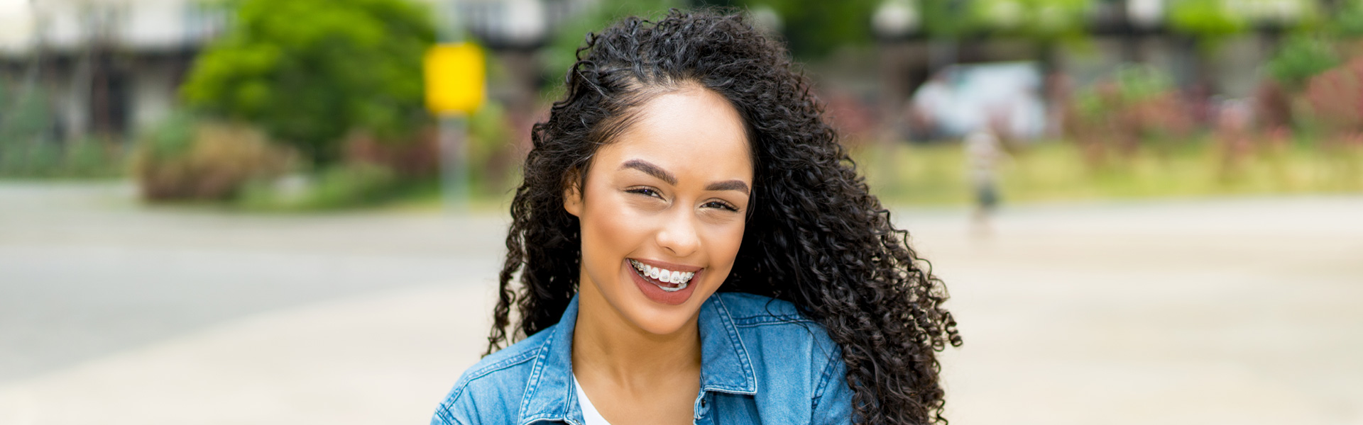 What Are The Benefits of Clear Braces?