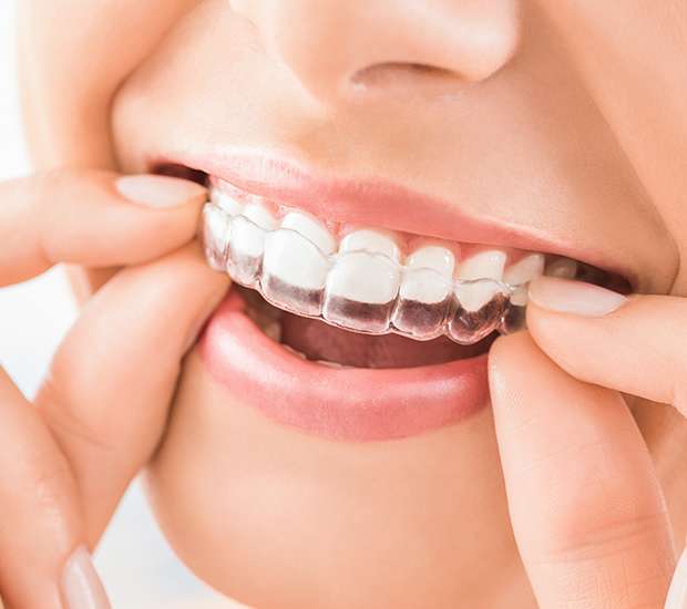 Gilbert Does Invisalign Really Work