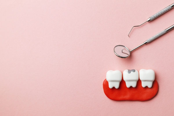 When Do You Need A Dental Filling? Signs And Symptoms To Watch For